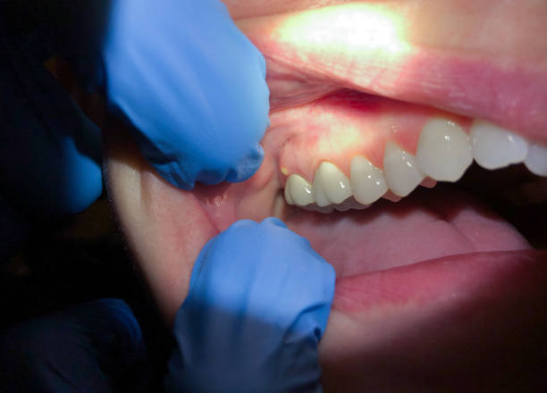 Best Emergency Treatment for Jaw Pain or Injury in Bear, DE